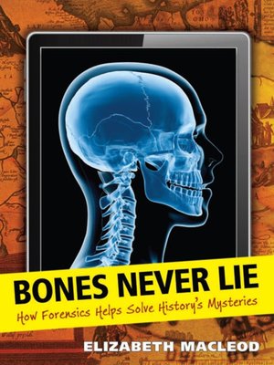cover image of Bones Never Lie